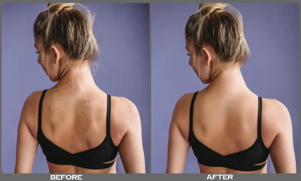 high end photo retouching, skin retouch