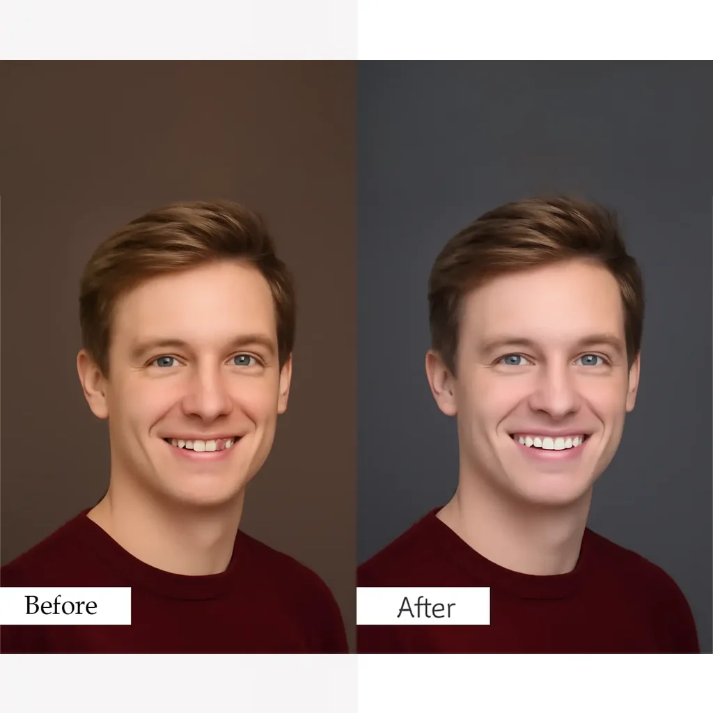 Teeth whitening & eye correction